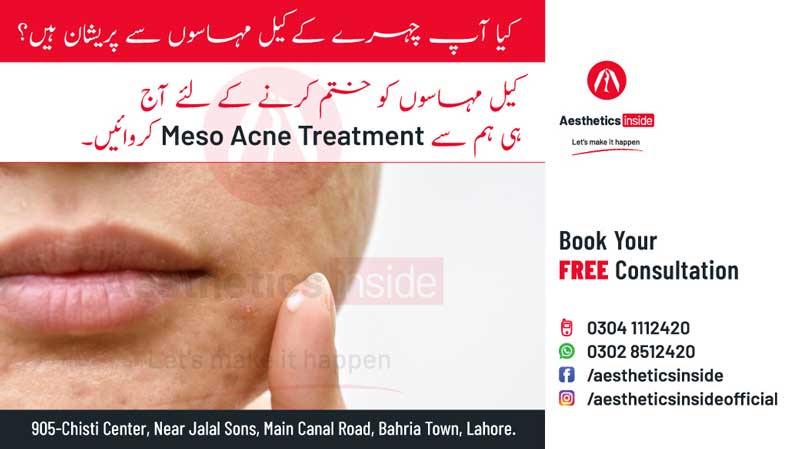 Meso-Acne-Twitter